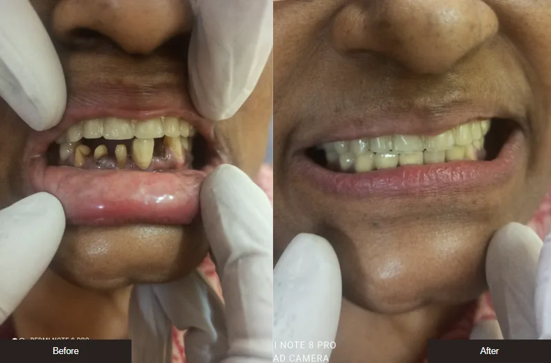 Case 2 — before