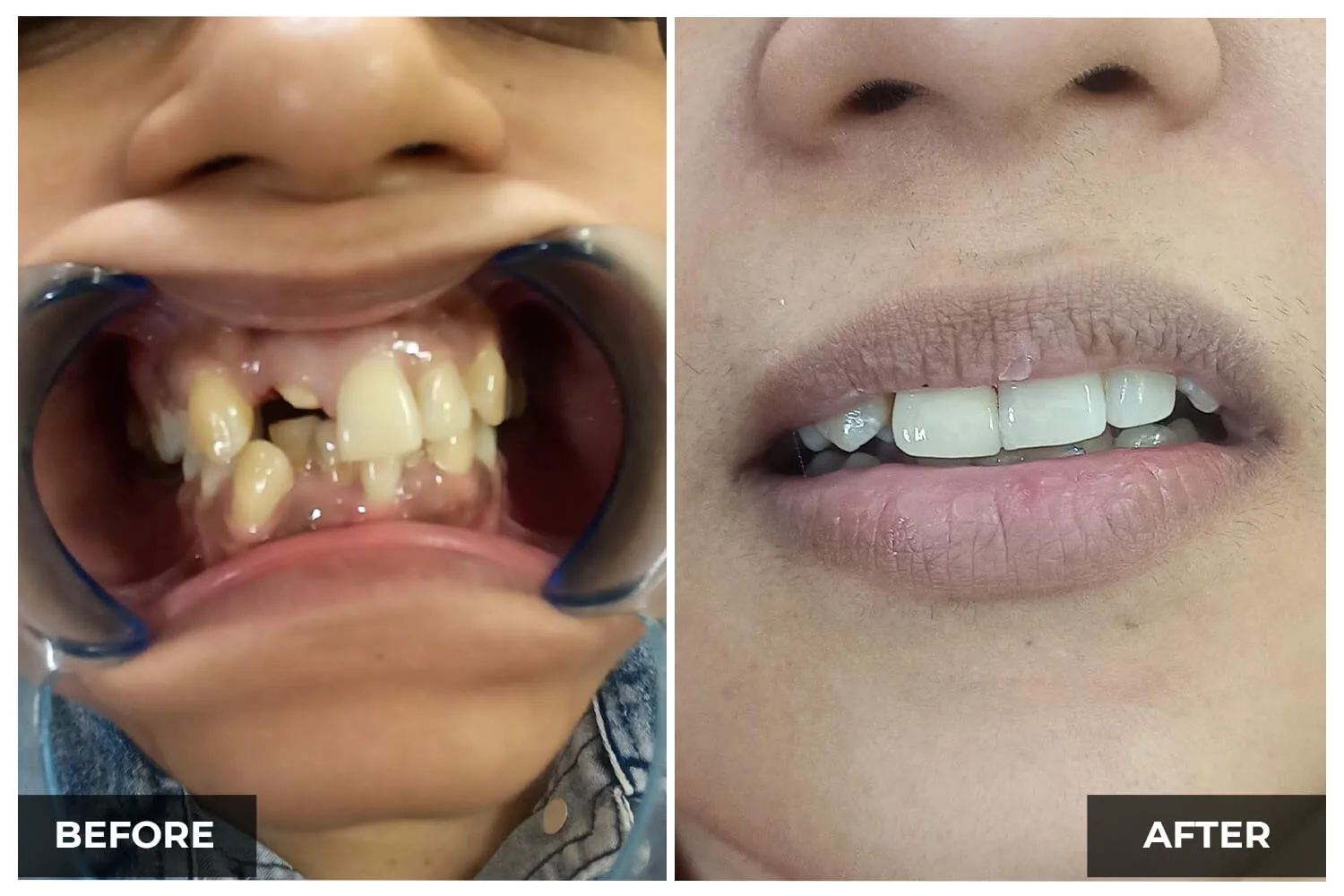 Case 4 — before