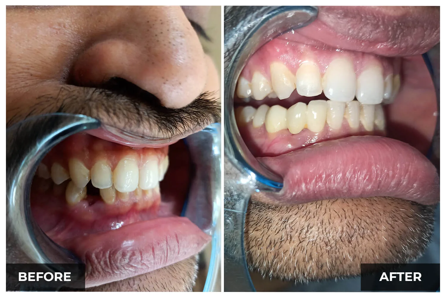 Case 5 — before