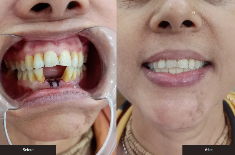 Case 6 — before
