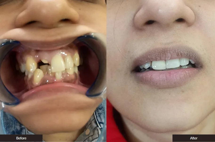 Case 7 — before