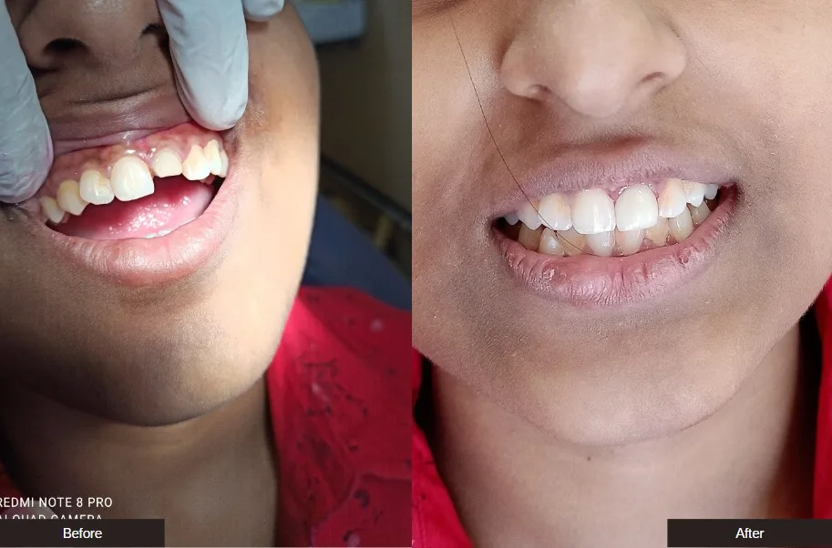Case 8 — before