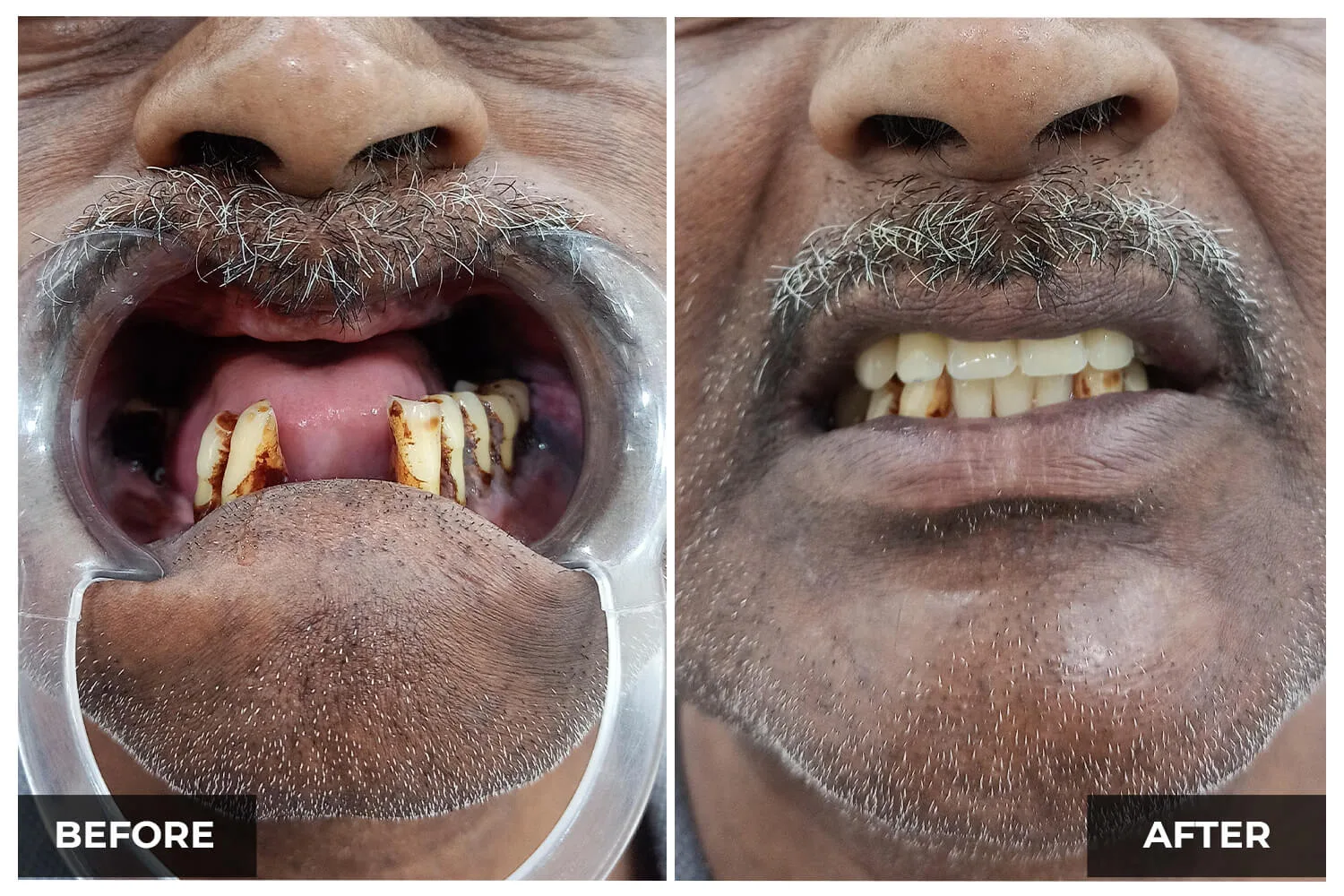 Case 10 — before