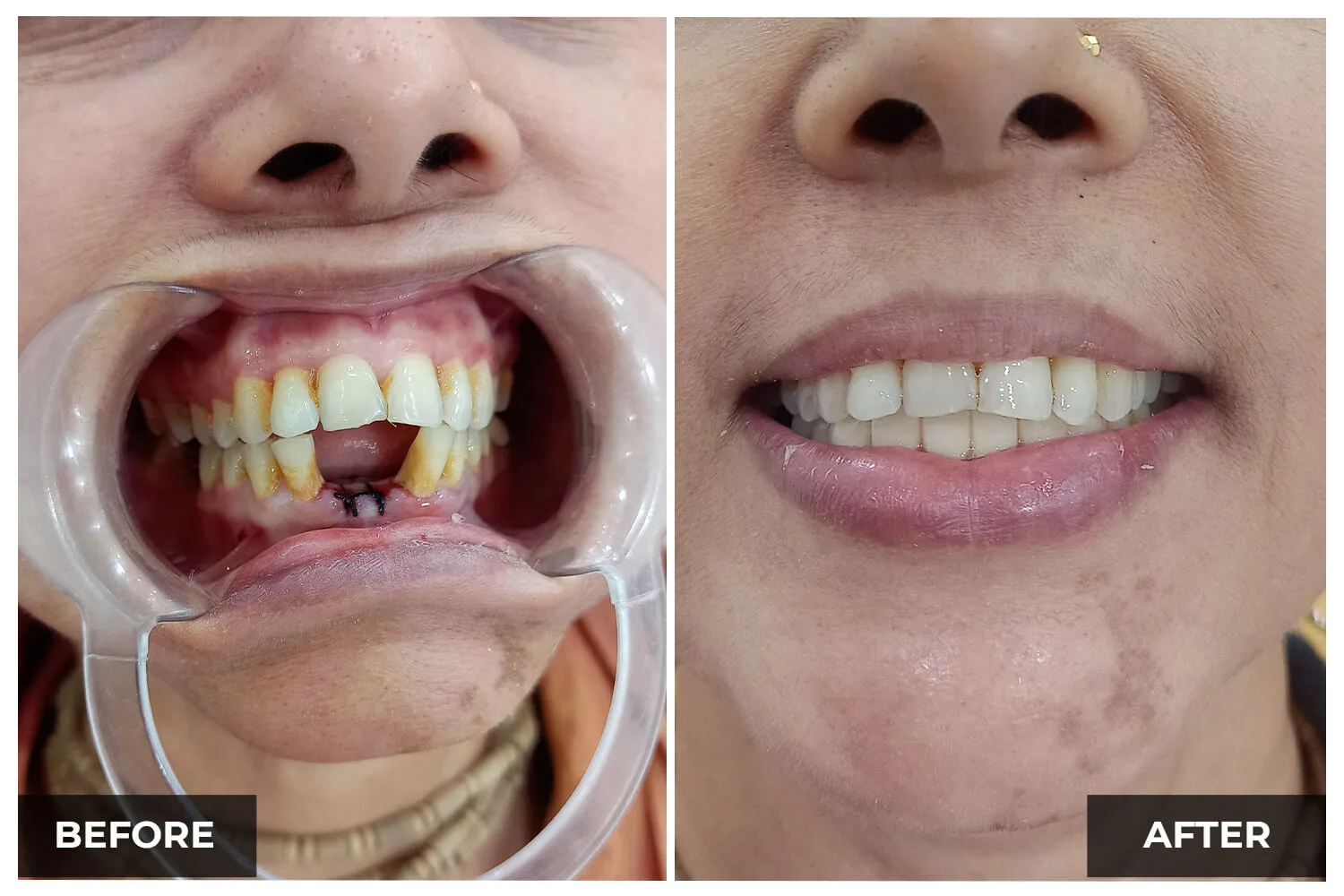Case 11 — before