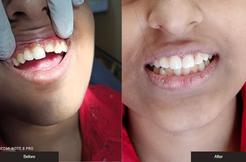 Case 13 — before