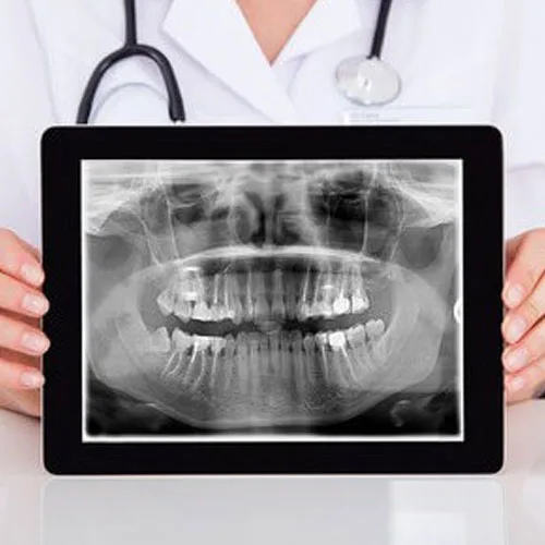 Digital X-Ray